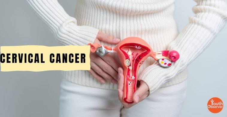 Cervical Cancer Can Be Prevented And Treated If Caught Early 1 Cervical Cancer