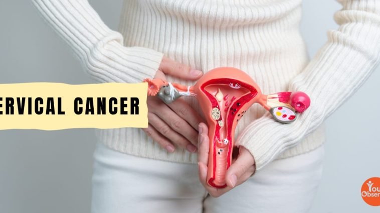 Cervical Cancer